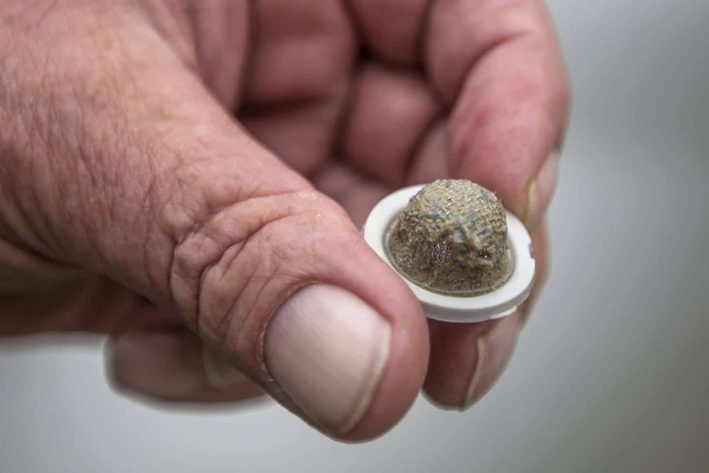 Ce filtre bouché d’un arroseur de jardin à Temuka, en Nouvelle-Zélande, aurait été bouché par des fibres d’amiante.