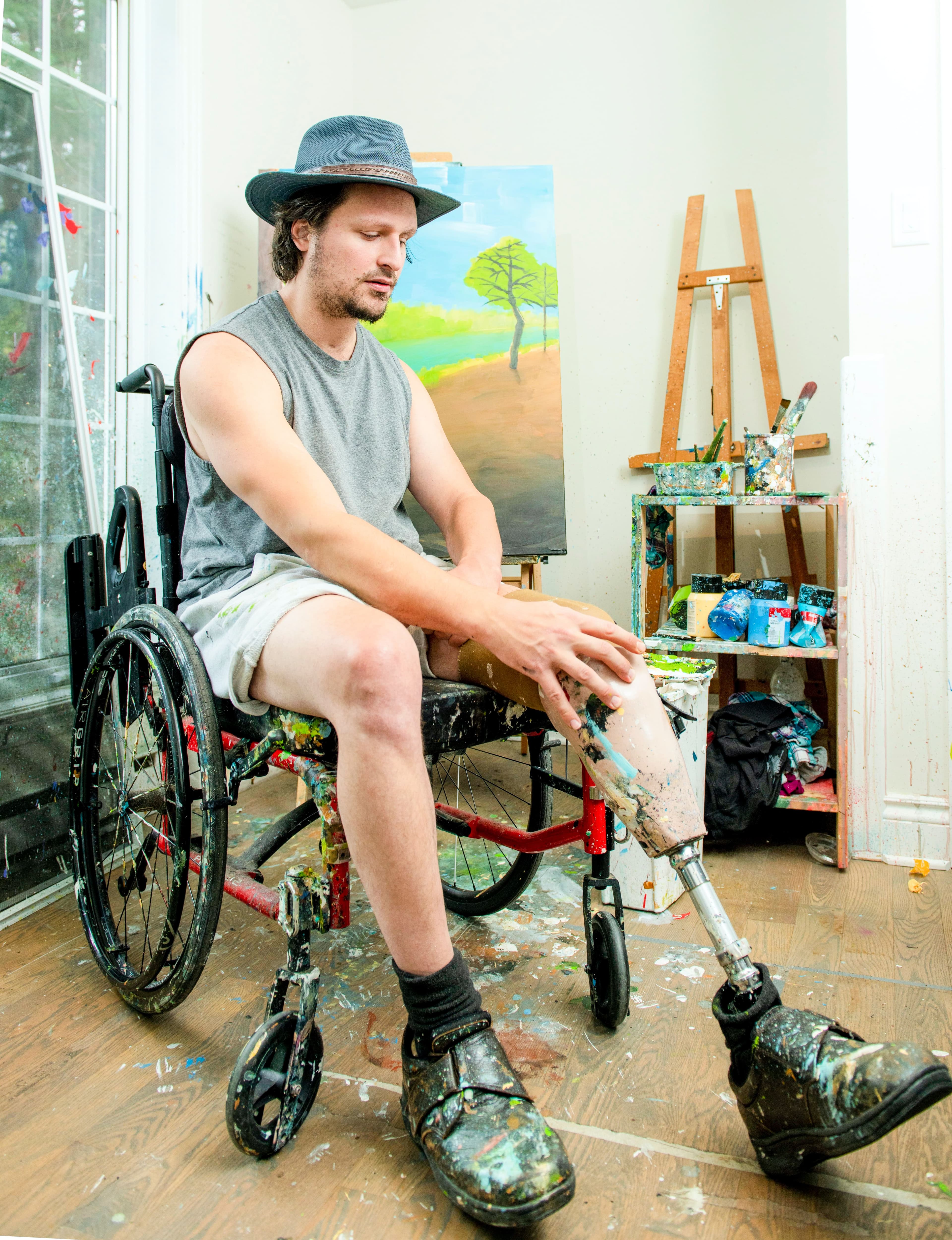 Éric Rado, amputé après avoir été laissé pour mort par un chauffard ivre en 2012.