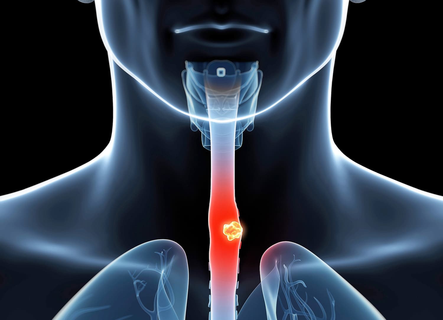 Illustration Adobe Stock