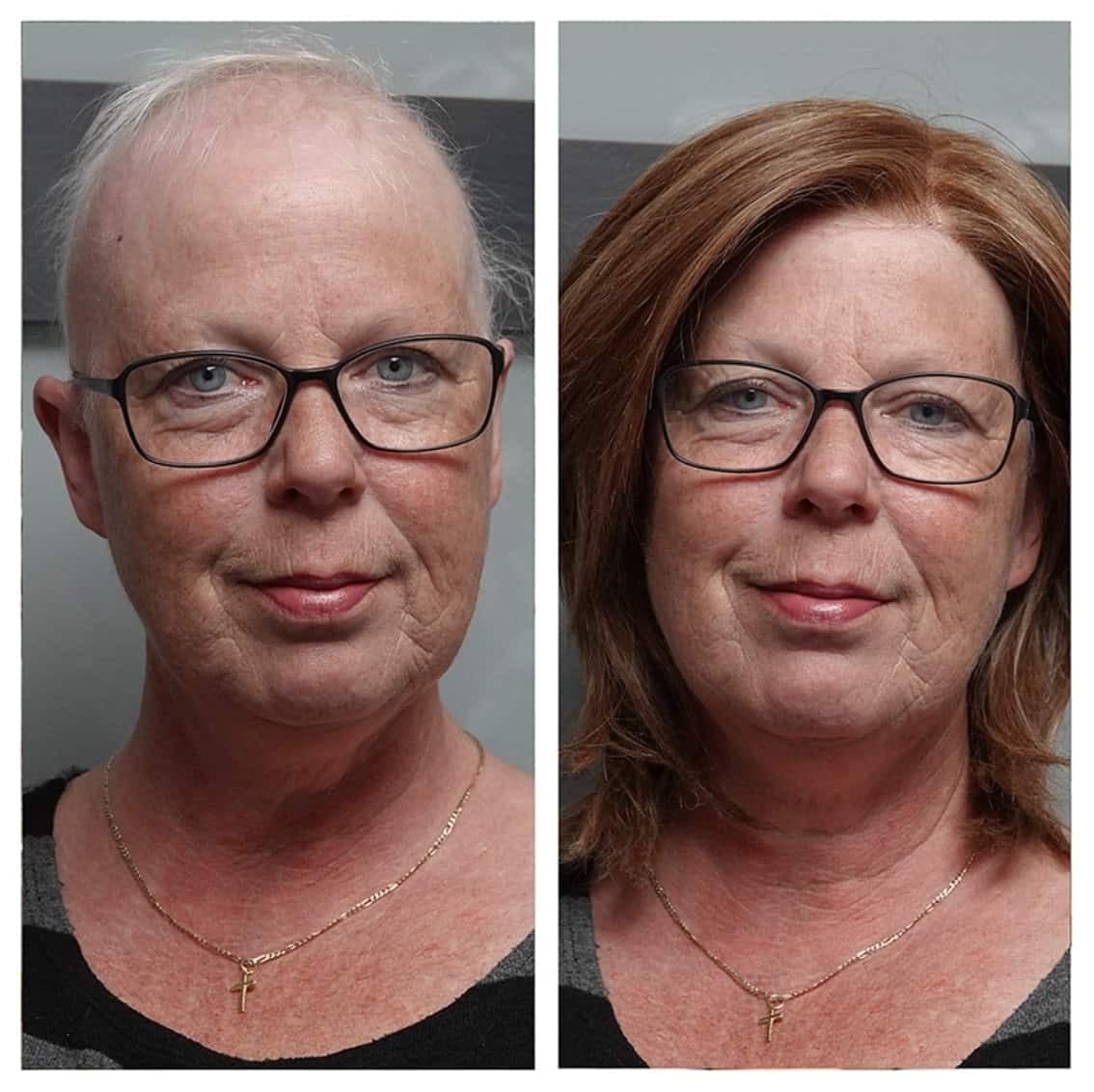 Courtoisie Danielle Perrault – Prothèses capillaires