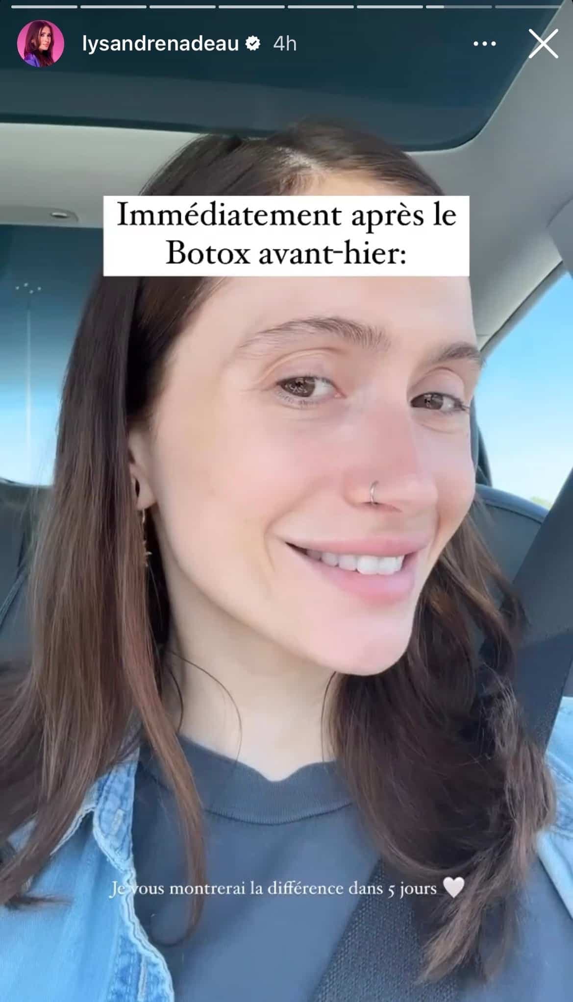 STORY INSTAGRAM / LYSANDRE NADEAU