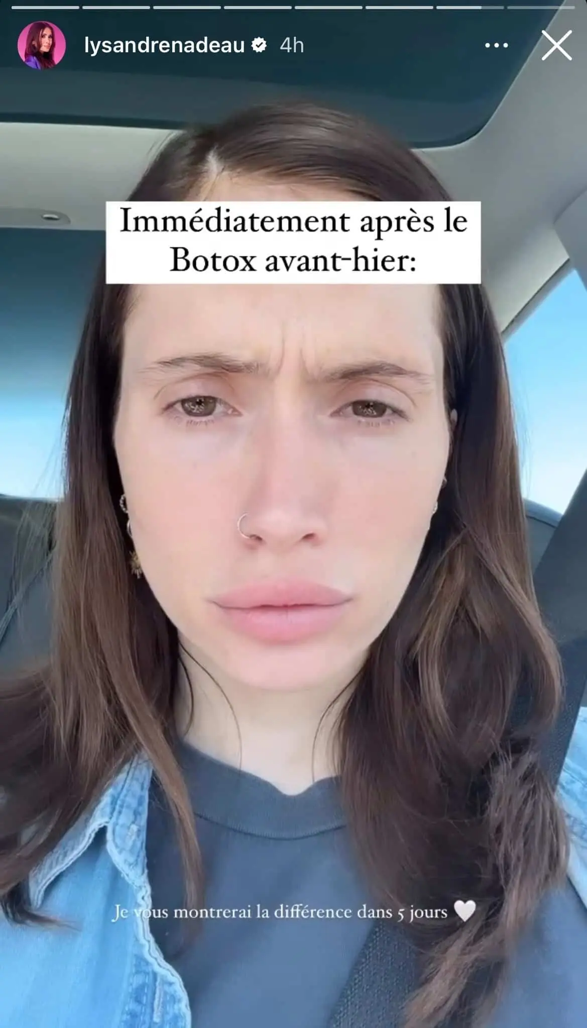 STORY INSTAGRAM / LYSANDRE NADEAU