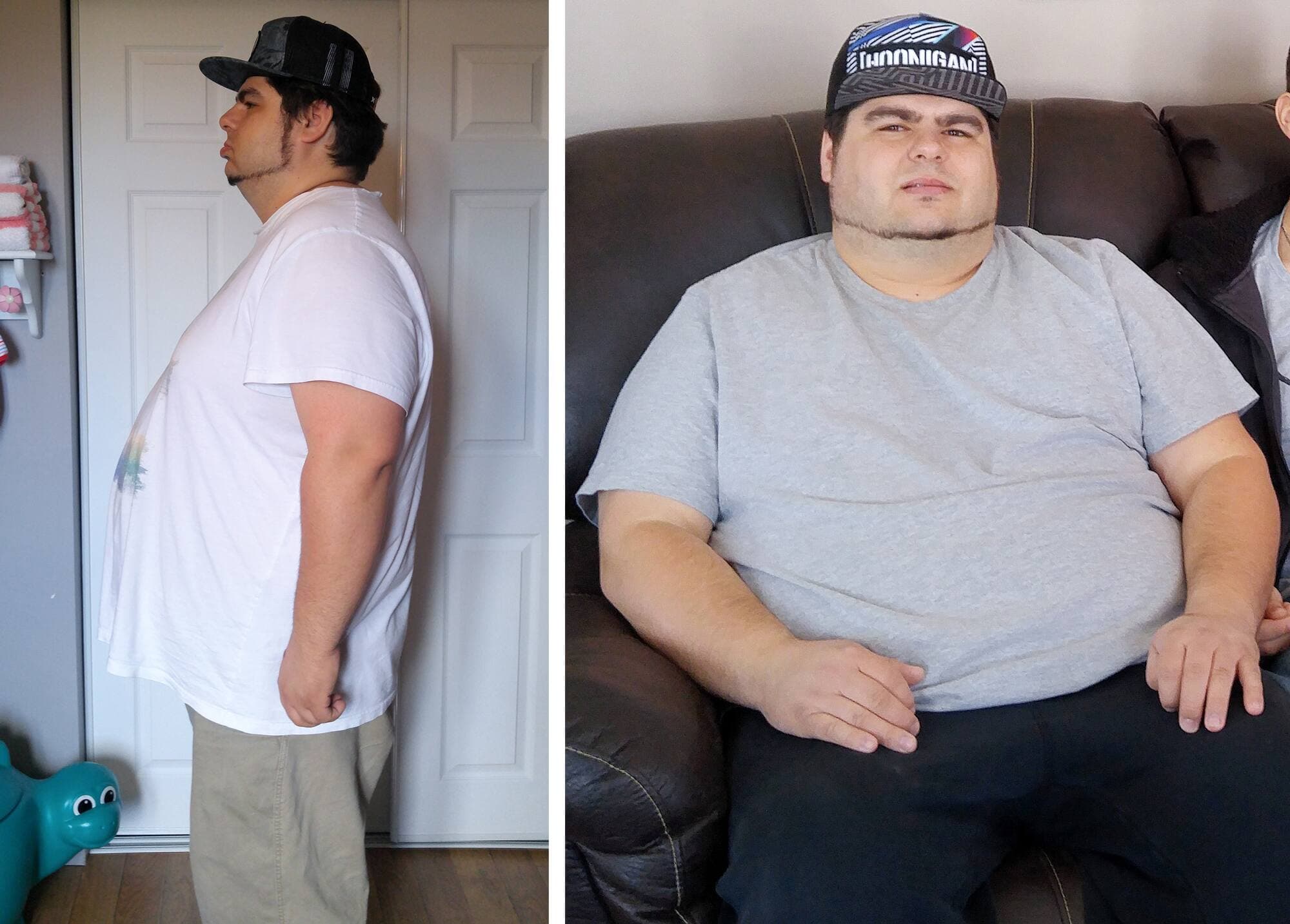 AVANT. Avant d’entreprendre des changements radicaux dans son mode de vie, Dany Lessard a atteint le poids colossal de 350 livres.